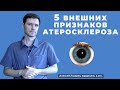 5 ВНЕШНИХ ПРИЗНАКОВ АТЕРОСКЛЕРОЗА #5признаковатеросклероза #атеросклероз #ДокторАлексейЛазарев