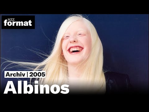 Video: Albino-Typ: Foto, Beschreibung der Krankheit