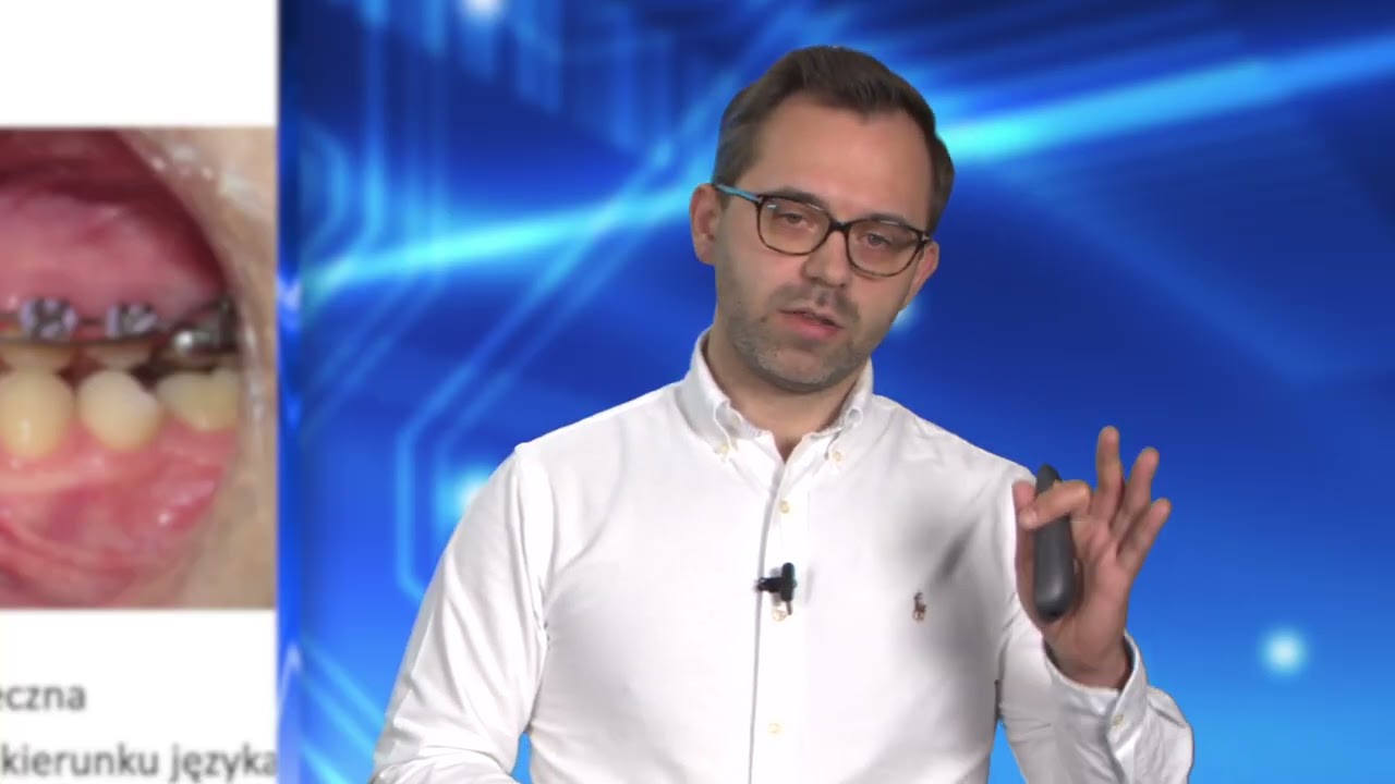 Biomechanika ortodontyczna   Dr Marcin Stasiak