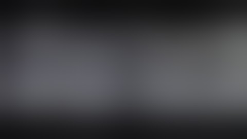 Right Endosocpic delayed optic nerve decompression by Dr Ashwin V G