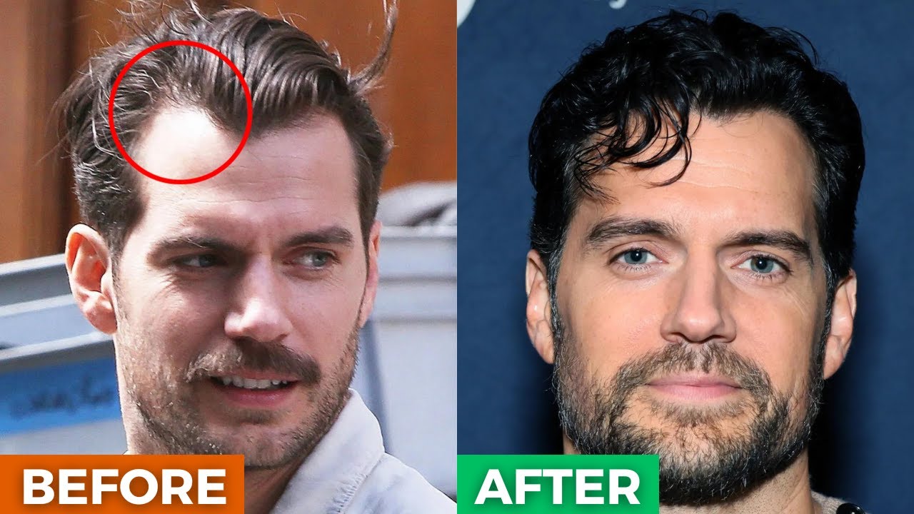 Hairstyles for Men with a High Forehead or Receding Hairline - TheSalonGuy  - YouTube