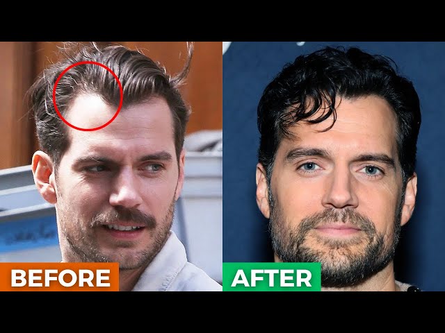 Widows Peak Hairstyle 6 ⋆ Best Fashion Blog For Men - TheUnstitchd.com