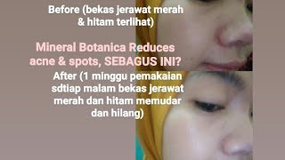 Review Mineral Botanica Reduces acne & spot treatment  (Obat totol jerawat terbaik 2020) - Maya