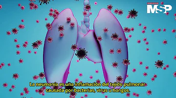 ¿Cómo se ve la neumonía en los pulmones?