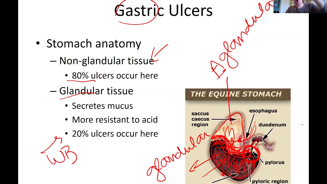 colic in horses part 1 gastric ulcers YouTube