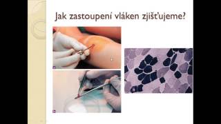 Fyziologie Sportu -Svaly 2 - Typy Svalových Vláken