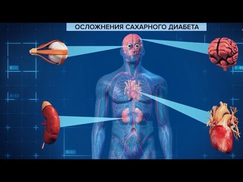 14 ноября – Всемирный день борьбы с сахарным диабетом