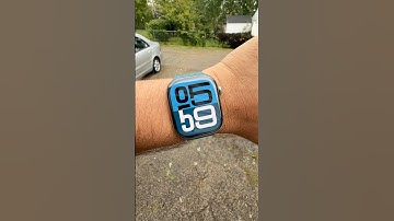 Best Apple Watch Face and Band Combo Ever! 😍