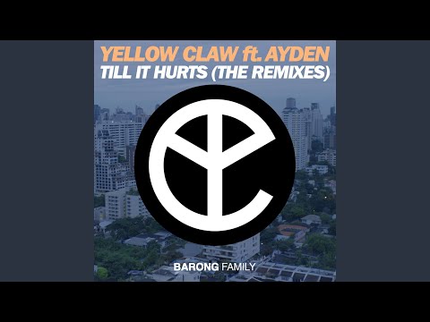 Putar Till It Hurts (SirOJ Remix) - Yellow Claw