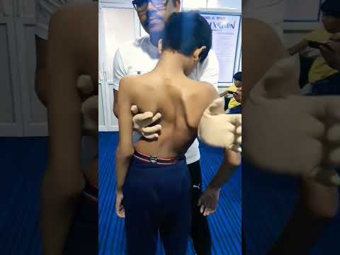 Cura para la