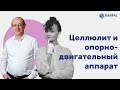 О ЦЕЛЛЮЛИТЕ и опорно-двигательном аппарате с остеопатом Александром Канцепольским