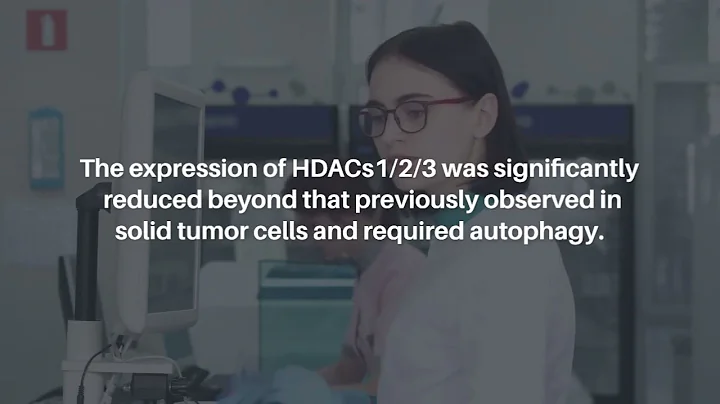 GZ17-6.02 Interacts with Proteasome Inhibitors to Kill Multiple Myeloma Cells | Oncotarget