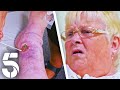 A Severely Swollen Knee | GPs: Behind Closed Doors | Channel 5