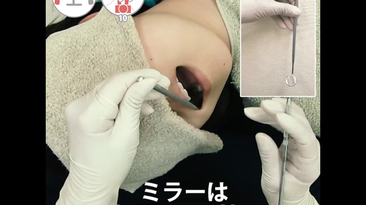 基本検査　実践編　～ポジション・レスト～　01. 右上7ー4解説編