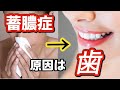 蓄膿症は歯医者で治ります!【副鼻腔炎】