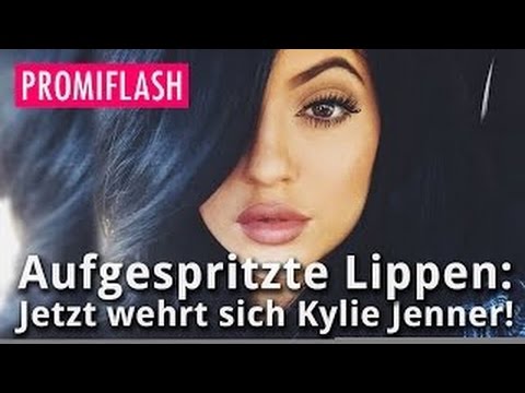 Video: Was Ist Mit Kylie Jenners Lippen?