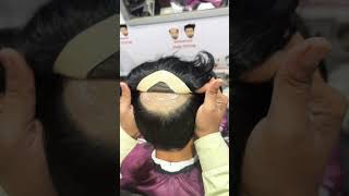 Best quality hair patch in Buxar Bihar|#hairwig # #wigs #hairpatch #hairline #lifeisbutadream #hair