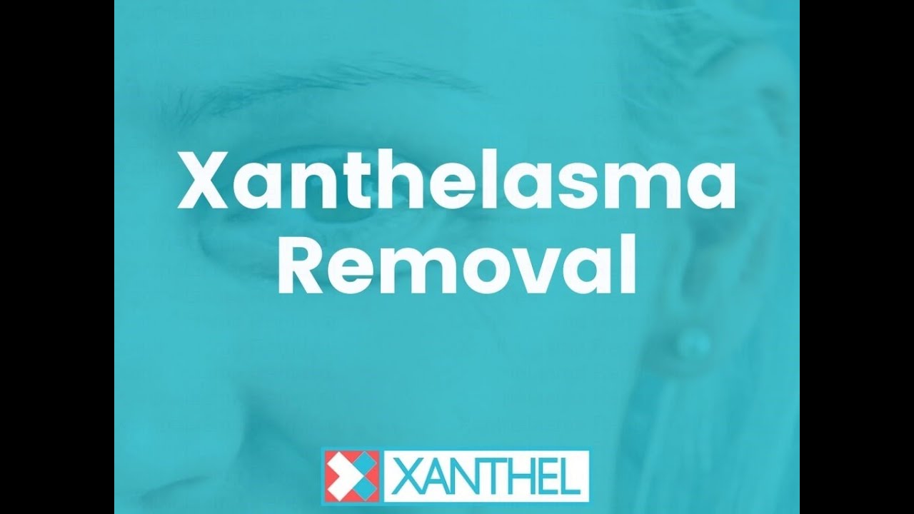 XANTHELASMA REMOVAL Fast and easy with XANTHEL ® The worlds 1