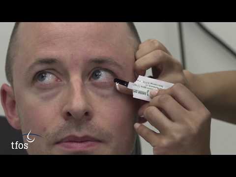 TFOS DEWS II Diagnostic Videos - Ocular surface damage