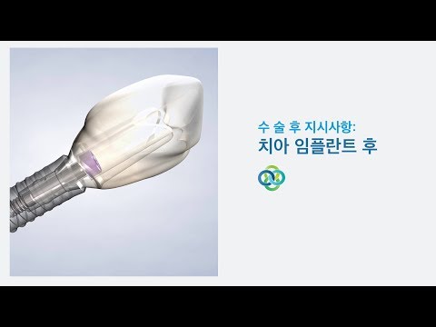 수술 후 지시사항: 치아 임플란트 후 | Oral Surgery Hawaii