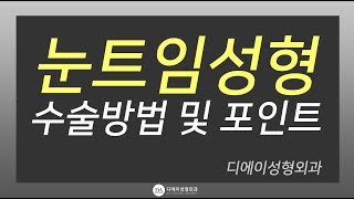 디에이성형외과 눈트임성형 수술