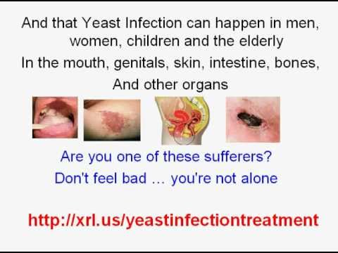 what infections does klacid treat