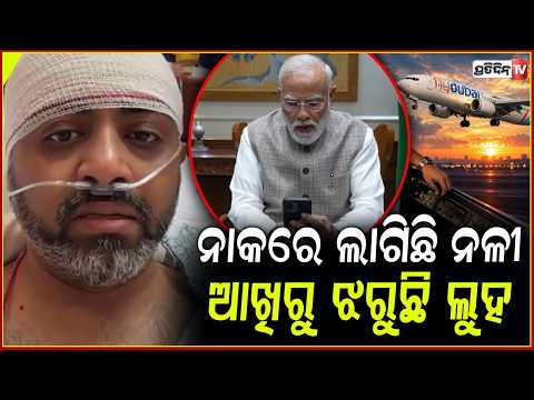 ନାକରେ ଲାଗିଛି ନଳୀ,ଆଖିରୁ ଝରୁଛି ଲୁହ:ସ୍ମିତ୍ ଙ୍କ ସହ କଥା ହେଲେ ମୋଦି!pm modi phone calls to smit-machchhar