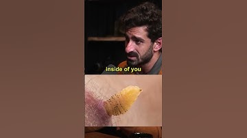 Paul Rosolie - Botflies Inside Skin