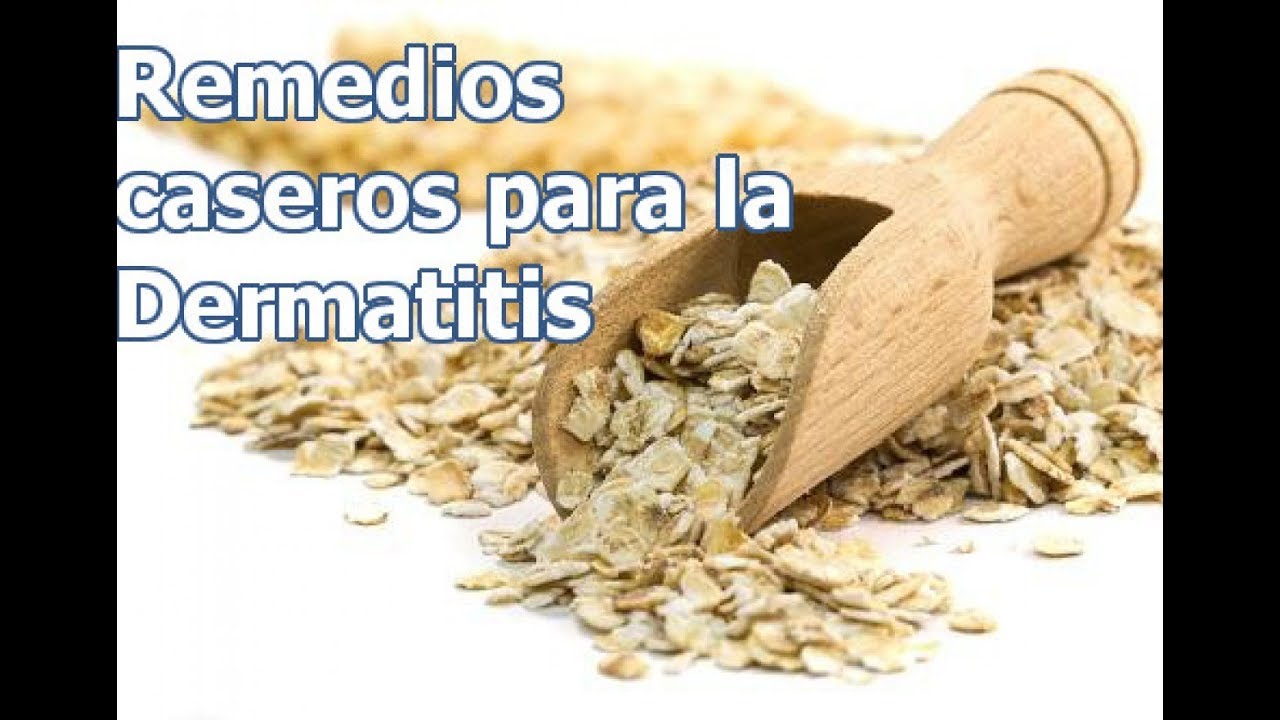 Remedios caseros para la dermatitis Atópica 🤕 YouTube