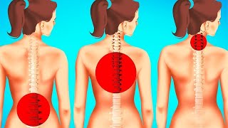 5 Best Exercises to Relieve Lower Back Pain