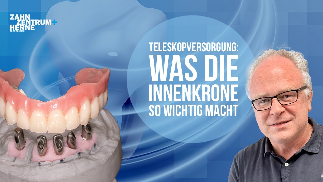 Teleskopversorgung: Was die Innenkrone so wichtig macht