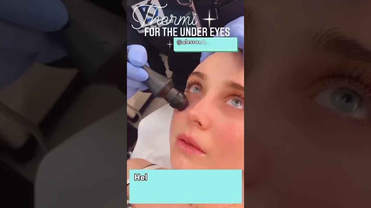 Thermi for the undereyes! Get rid of any texture.