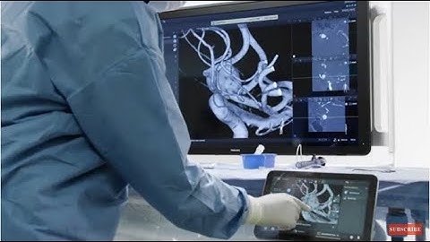 Simplifying and advancing 3D imaging with SmartCT