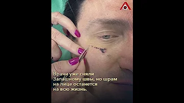 «Погибли двое коллег»: Запашный об инциденте с тигром
