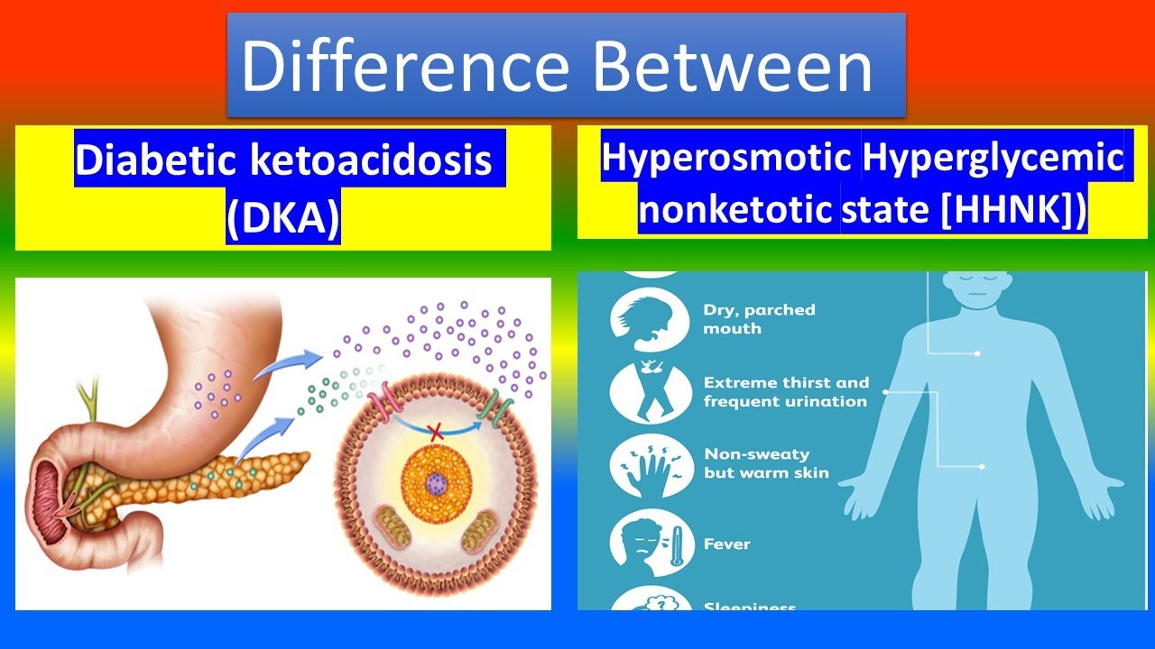 Diabetic ketoacidosis (DKA) Vs. Hyperosmotic Hyperglycemic nonketotic state ( HHNK )