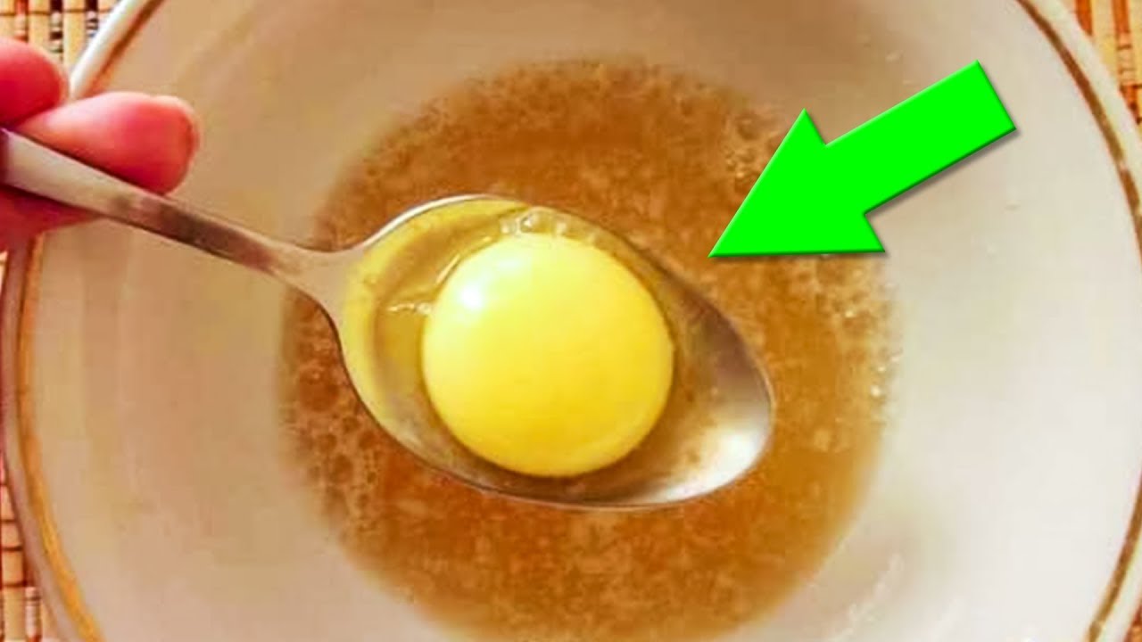 Рецепт от пяточной шпоры. Утром не могла стать на пятку, сделала ...