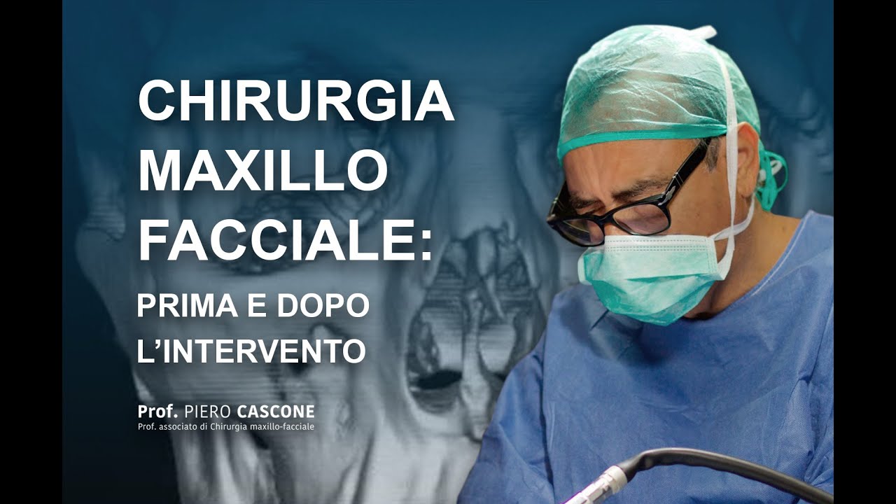 YouTubeでPRIMA E DOPO: intervento ATM Chirurgia Maxillo-faccialeを視聴 YouTubeでPRIMA E DOPO: intervento ATM Chirurgia Maxillo-faccialeを視聴