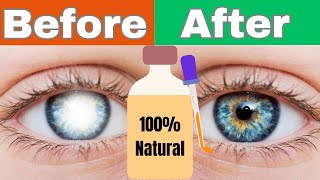 Castor Oil For Your EYES: Fix Dry Eyes, Cataracts, and Eye Floaters
Castor oil is an amazing oil for your eyes. Castor oil is a natural remedy for cataracts, dry eyes, pink eye, glaucoma, and more. Castor oil is a natural treatment option to help with cataracts to lessen the symptoms or to get rid of them completely. Castor oil works different for everyone depending on how well you take care of your over all health and diet. Castor oil is 100% natural and easy on the eyes. It is the best remedy to try as it wont hurt you and is all natural and not expensive. Castor oil is excellent for your overall eye health. Castor oil can even help with eye floaters.
➡️Subscribe Its FREE! ➡️ https://www.youtube.com/@SolarGirlHomestead
✨Join this channel to get access to perks:
https://www.youtube.com/channel/UCyKbucbuIlAOI4agsi2pV0Q/join
➡️WATCH RELATED VIDEOS:
▶️ My COOKING CHANNEL https://www.youtube.com/@potoffood
▶️The Best Moisturizer: Removes wrinkles, age spots.... https://youtu.be/NaVP7v5rM9Q
▶️Honey for your eyes https://youtu.be/KxBgmQYM4Vc
▶️ 21 Health benefits of coconut oil https://youtu.be/1G2rB2m-yoE
▶️ I quit Sugar for 2 weeks https://youtu.be/85rDl0R5GX4
▶️Ginger tea benefits https://youtu.be/8iBCqwDrmnM?si=MTfQnMMjTQHZL-4V
▶️How to Detox your liver with turmeric https://youtu.be/ITg2VAKQ6aw
▶️ Turmeric Tea https://youtu.be/vE56xjyDOgw
Some of my links below are affiliate links, which means if you make a purchase, I make a small commission at no extra cost to you. :-)
✳️My Favorite Store:
You can buy rose geranium oil here https://tinyurl.com/rosesgh
➡️Custom Cutting Board with recipe https://tinyurl.com/ccuttingboard
➡️ Make money from your Homestead 30 easy ways https://www.udemy.com/course/how-you-can-get-paid-to-be-a-homesteader/?referralCode=46DDF2BB9824AAA3DEF9
➡️Custom Garden Sign https://www.greengardenchicken.com/index.php?route=product/category&path=266_267
➡️Best Greens Powder this link goes directly to their storehttps://tinyurl.com/sggreenspowder
📬EMAIL: https://www.youtube.com/@SolarGirlHomestead/about
📝COMMENTS:
If you have any questions or comments, please post them below. Im happy to answer your questions, and I look forward to hearing from you!
❤️THANKS FOR WATCHING!❤️
#SolargirlHomestead #castoroil #cataracts #health
▶Disclaimer: I am schooled in nutrition, but I am not a medical doctor. The content is not intended to be a substitute for professional medical advice, diagnosis, or treatment. This video is for entertainment purposes only. Always seek the advice of your physician or other qualified healthcare provider with any questions you may have regarding a medical condition or proper nutritional advice. Never disregard professional medical advice or delay in seeking it because of something you have watched on this video. Castor Oil For Your EYES: Fix Dry Eyes, Cataracts, and Eye Floaters