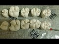 class 1, class 2 cavity preparation on plaster model  ।। preclinical conservative dentistry. part 1