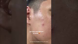 The Body Shop Skincare Consultation