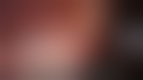 Robotic retrohepatic caval dissection for right hepatectomy | Narrated tutorial