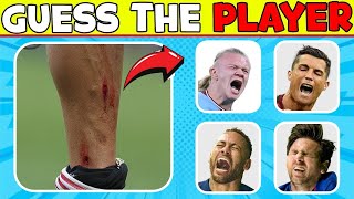 Guess Football Player by his INJURY and RED CARD ❤️‍🩹🏐 Football Quiz about Ronaldo, Messi, Neymar🏐