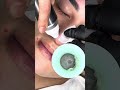 #asmr #Bubble毛穴洗浄#毛穴洗浄#角栓 #メンズ専門
