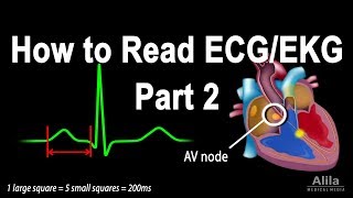 How to Read ECG/EKG, Part 2, Animation