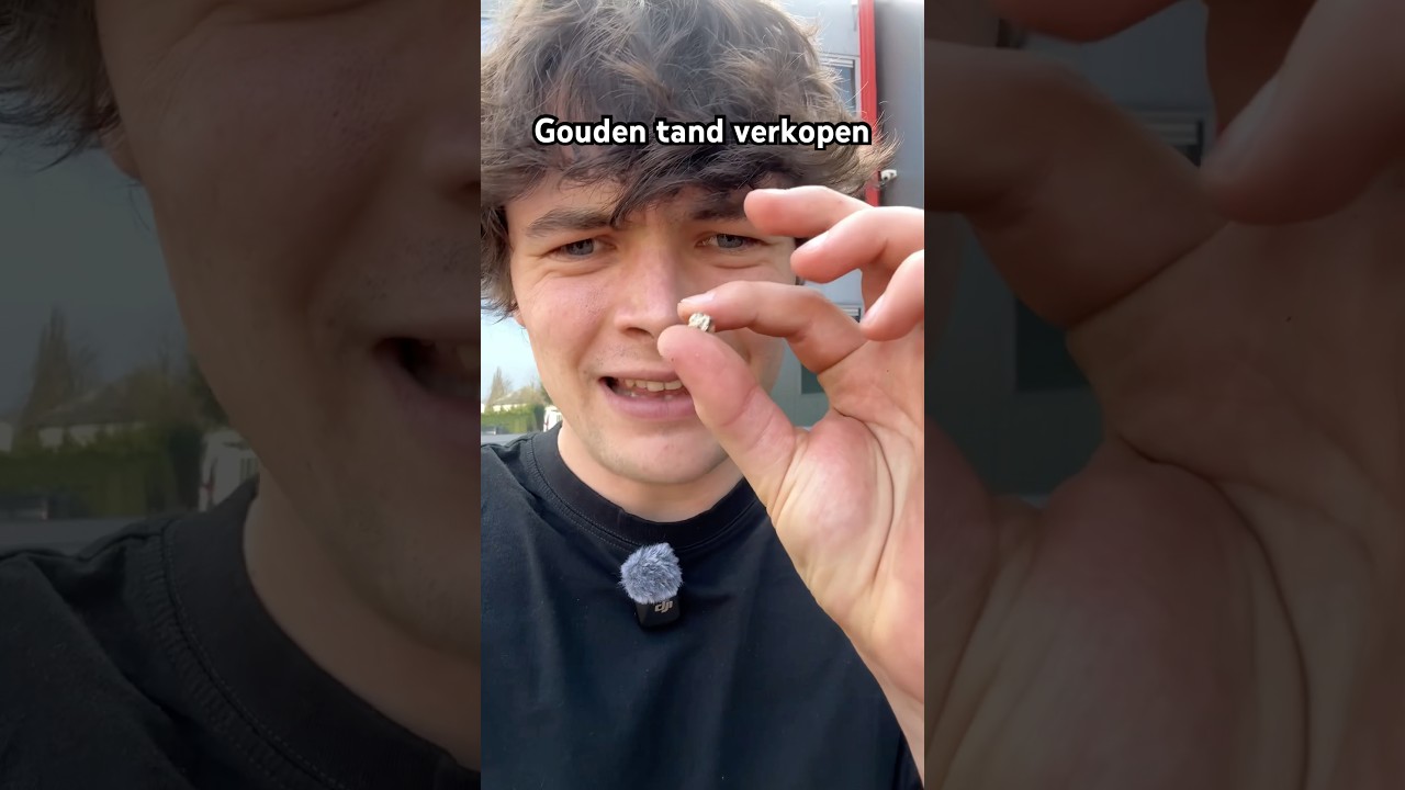 Hoeveel euro is een gouden tand waard? 🤔 - YouTube
