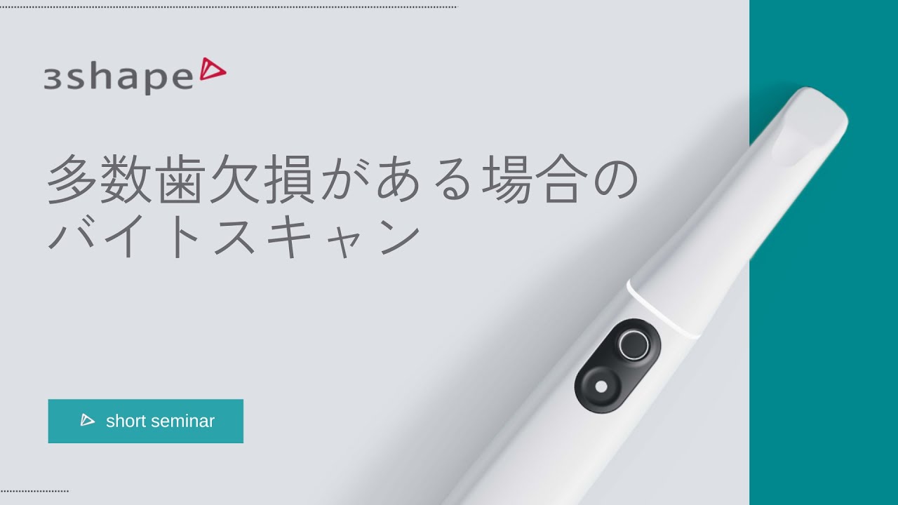 多数歯欠損の場合のバイトスキャンについて