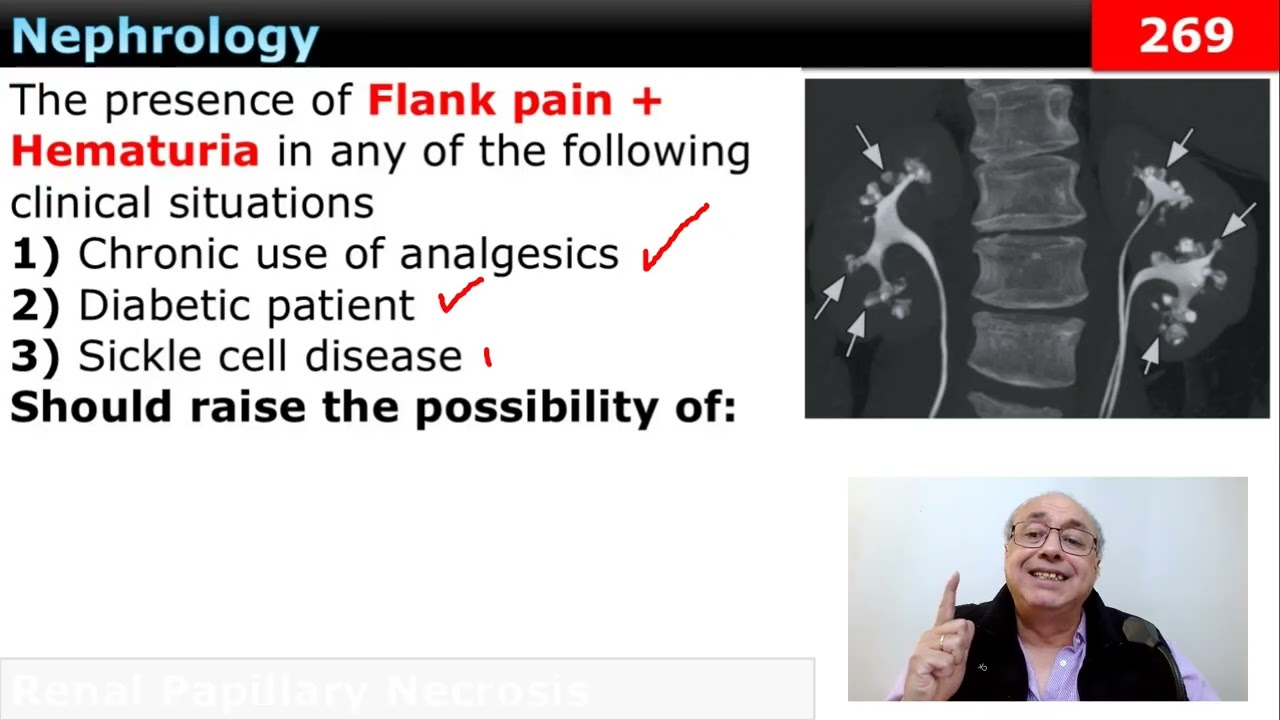 USMLE Step 2 CK [303]