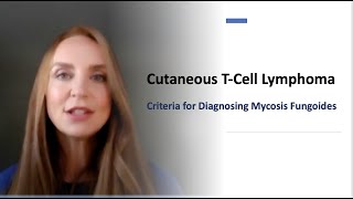 Criteria to Diagnose Mycosis Fungoides (Chapter 1)