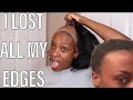 How To Remove Lace Wigs Gone Wrong | Lost All My Edges | Never Again