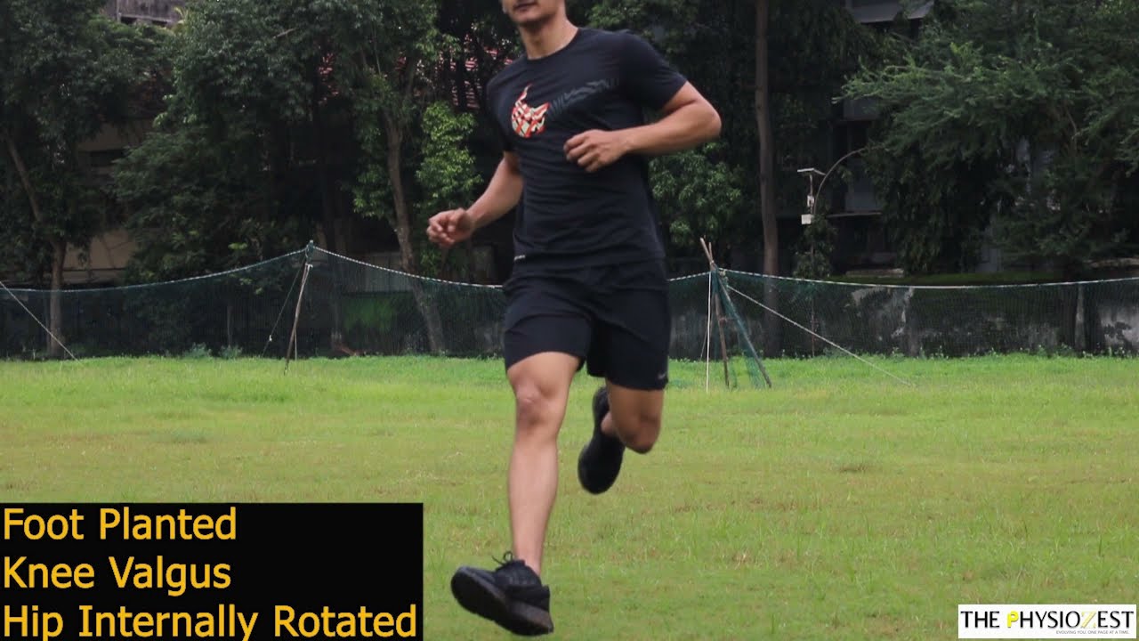 ACL: Mechanism of Injury